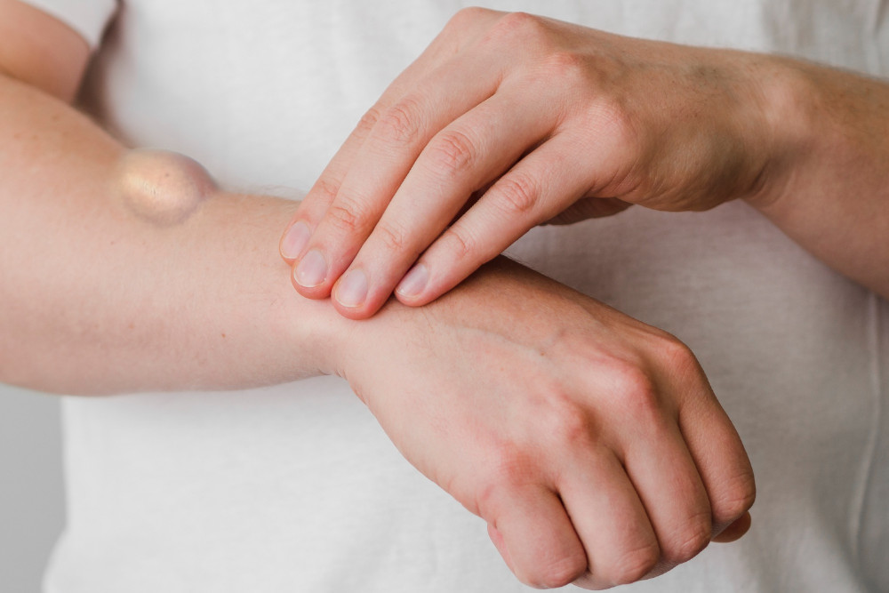 Tłuszczaki - czym są i jak się ich pozbyć?